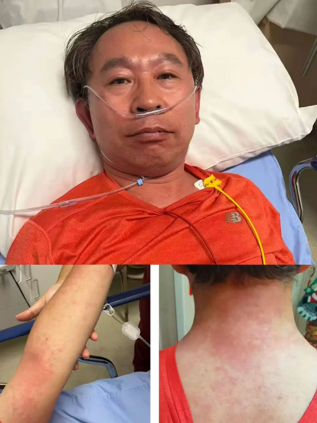 医生吃头孢遇险,“一不小心成为反面教材”,紧急提醒→(图1) 1a.png