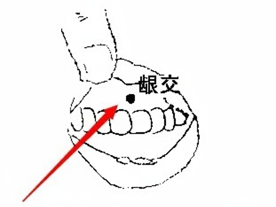 当代岐黄医理科学解读:头面部“终极穴位”神在哪里?(图5) 4.png